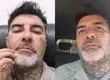 “Me rebotó la cabeza”: DJ Méndez denuncia que fue atropellado por funcionario de la Municipalidad de Isla de Maipo