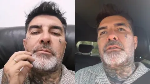 “Me rebotó la cabeza”: DJ Méndez denuncia que fue atropellado por funcionario de la Municipalidad de Isla de Maipo