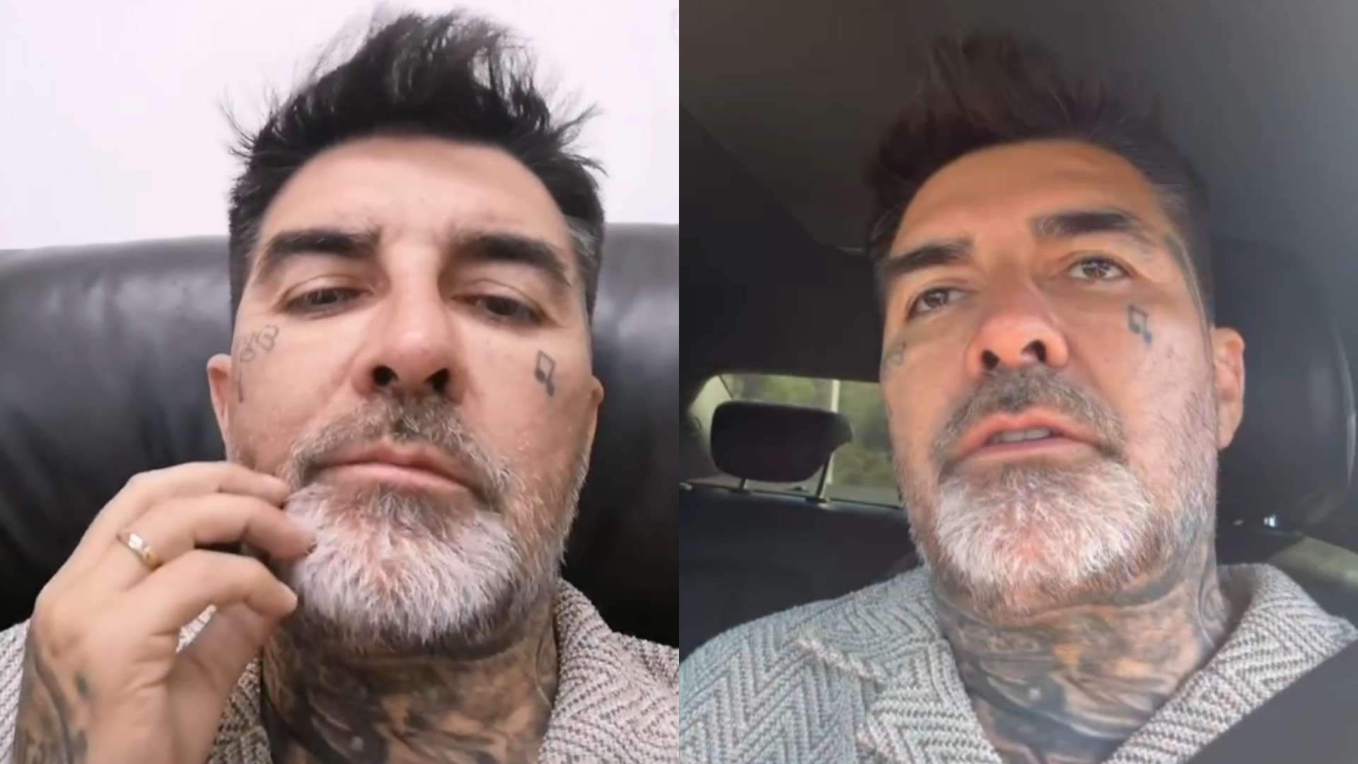 “Me rebotó la cabeza”: DJ Méndez denuncia que fue atropellado por funcionario de la Municipalidad de Isla de Maipo