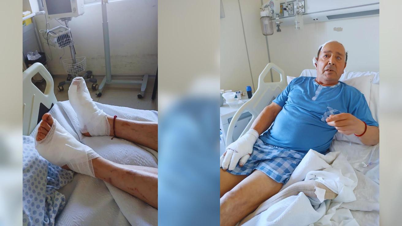 La historia de Humberto: Adulto mayor se quemó los pies por salvar a su nieta de los incendios forestales en Penco