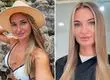 Conmoción por muerte de Yulia Burtseva, conocida influencer de 38 años: Se sometió a cirugía con médico falso