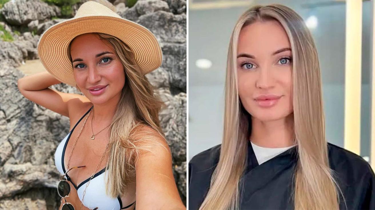 Conmoción por muerte de Yulia Burtseva, conocida influencer de 38 años: Se sometió a cirugía con médico falso