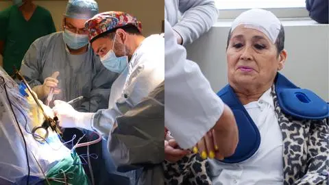 Hospital Regional de Concepción realiza primera cirugía por enfermedad de Parkinson: Resultados fueron “auspiciosos”