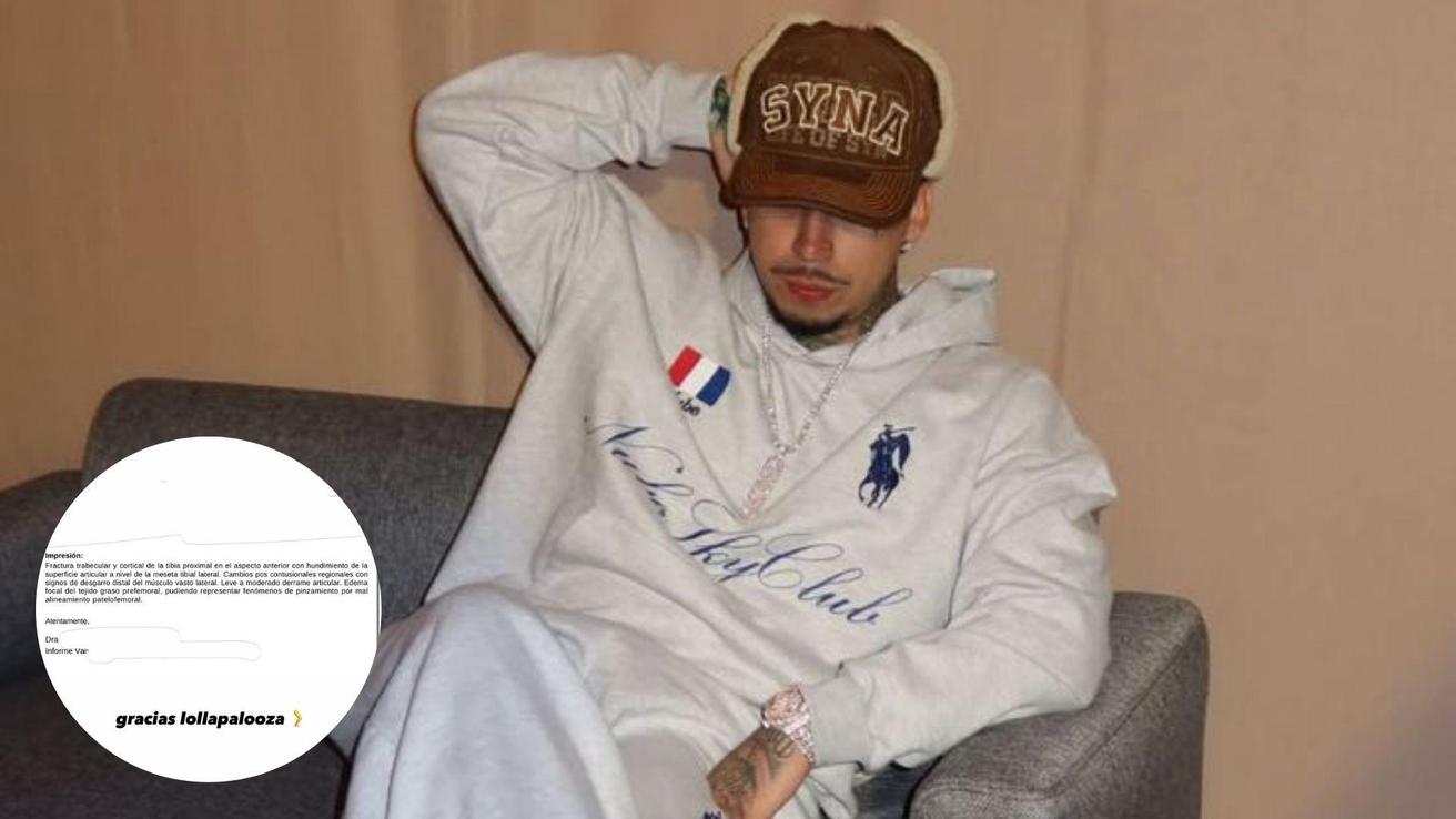 “Con muleta o cojo nos vemos”: Young Cister se fractura previo a su show en REC 2026