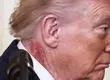 Extraña mancha roja ha aparecido en el cuello de Donald Trump: Su médico explicó estado de salud