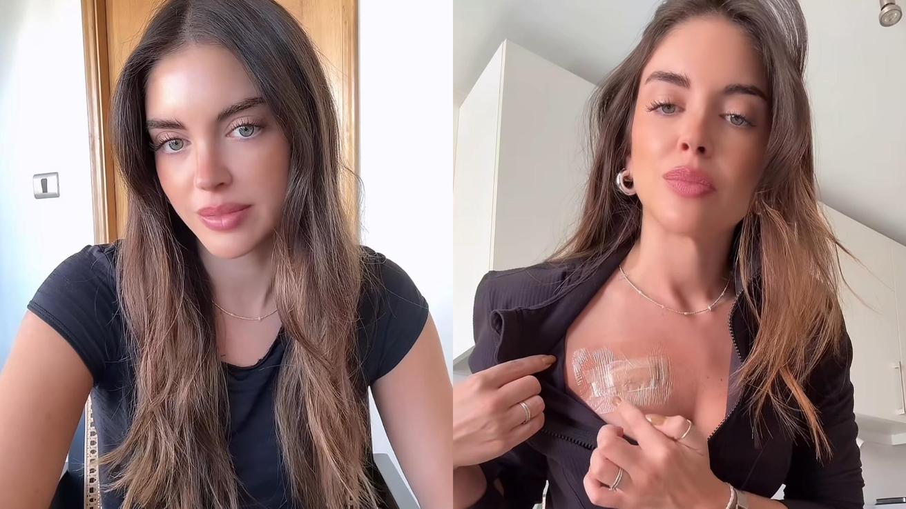 Recordada actriz e influencer reveló que fue diagnosticada con cáncer de piel: “No está grande todavía”
