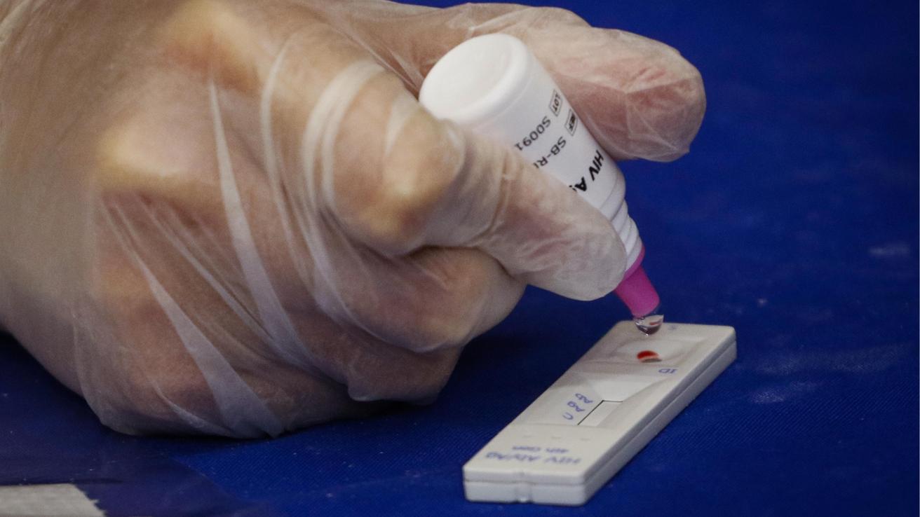 ISP alerta por comercialización de test rápidos de VIH en Chile: No cuentan con registro sanitario