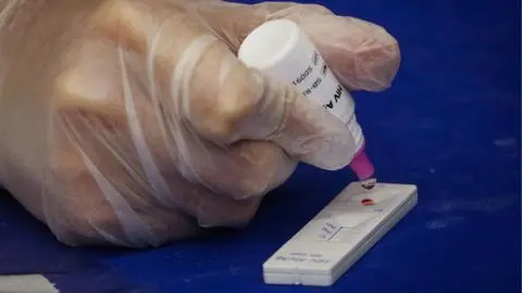 ISP alerta por comercialización de test rápidos de VIH en Chile: No cuentan con registro sanitario