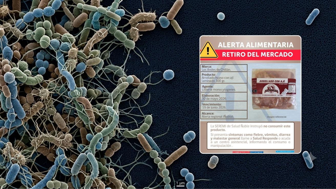 Alertan por bacteria peligrosa en alimento vendido en centro sur de Chile: piden no consumir lote afectado de su marca