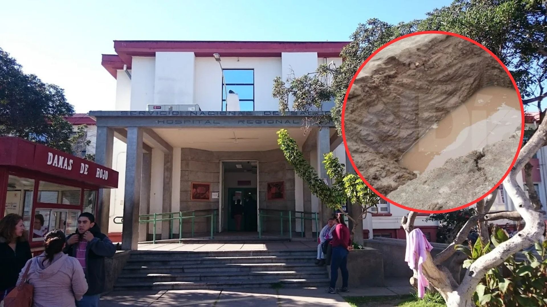 Tragedia en La Serena: Pesar por muerte de niña de 2 años que cayó a un pozo
