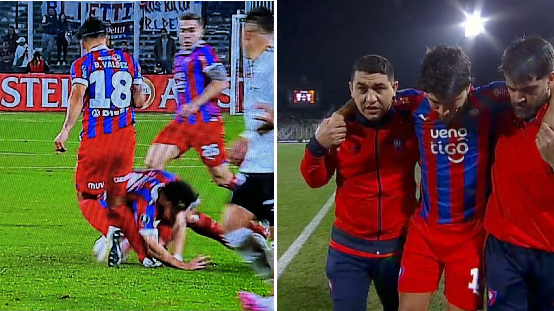 La terrible lesión de Bruno Valdéz ante Colo-Colo: Jugador de Cerro Porteño abandonó la cancha tras choque