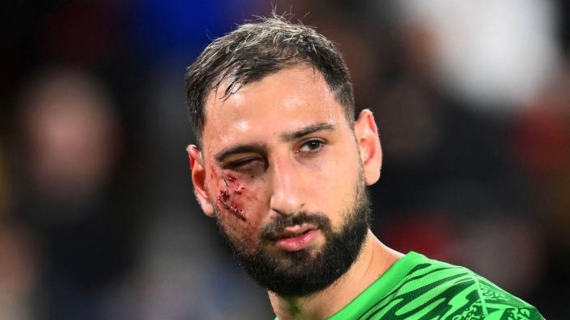 ¿La patada del año? La impactante imagen que da la vuelta al mundo en partido del PSG en Francia